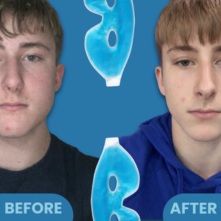 CryoForm Cooling Ice Eye-Mask