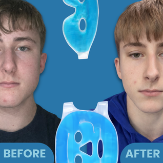 CryoForm Cooling Ice Face-Mask